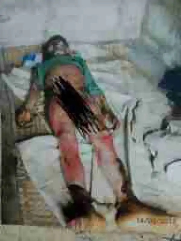 One Killed, Three Injured As Kerosene Lantern Explodes In Abia (Graphic Photos)